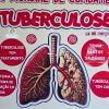 Painel dia mundial de combate à tuberculose - Image 4