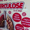 Painel dia mundial de combate à tuberculose - Image 6